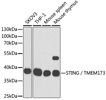 STING / TMEM173 Antibody