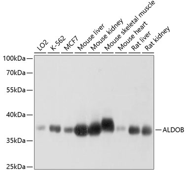 ALDOB Antibody