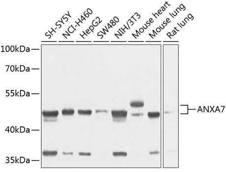 ANXA7 Antibody