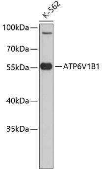 ATP6V1B1 Antibody
