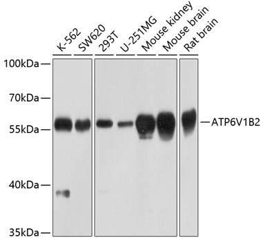 ATP6V1B2 Antibody