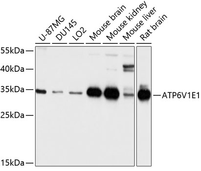 ATP6V1E1 Antibody