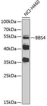 BBS4 Antibody