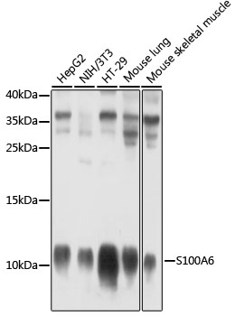 S100A6 Antibody, KO Validated