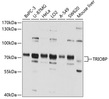 TRIOBP Antibody