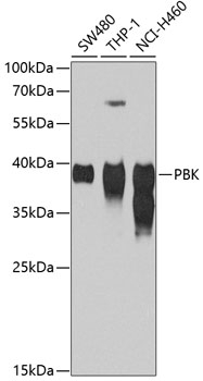 SPK Antibody