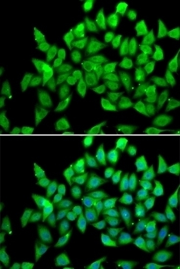 ALS2 Antibody