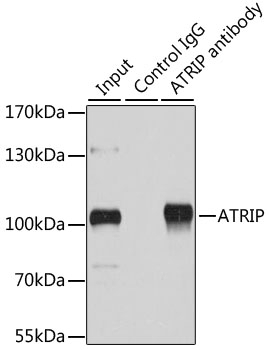 ATRIP Antibody