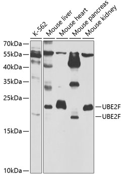UBE2F Antibody