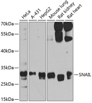 SNAIL Antibody