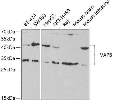 VAPB Antibody