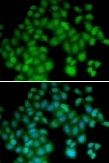 TMSB4X Antibody