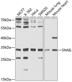SNAIL Antibody