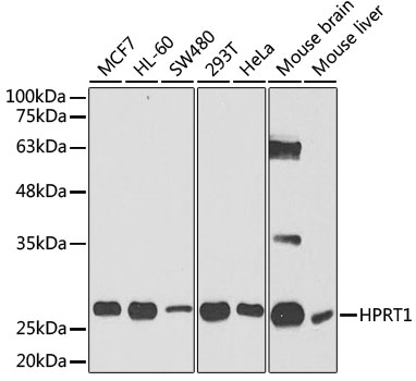 HPRT1 Antibody, KO Validated