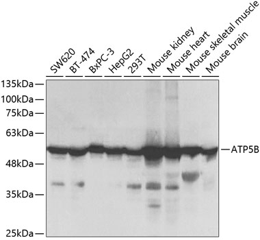 ATP5B Antibody