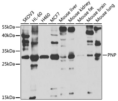 PNP Antibody