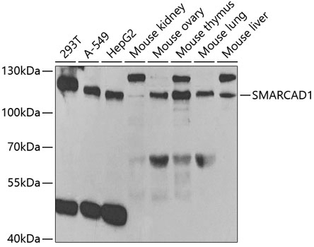 SMARCAD1 Antibody