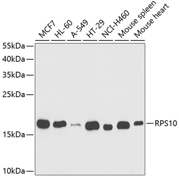 RPS10 Antibody