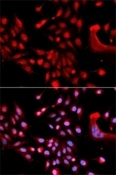 U2AF1 Antibody