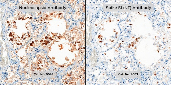 IHC of nucleocapsid and spike protein antibodies