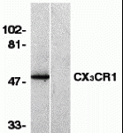 Western blot analysis of CX3CR1 in human spleen lysate with CX3CR1 antibody in the absence (lane 1) or presence of blocking peptide (2093P) (lane 2).