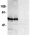 Western blot analysis of SODD in HeLa (1,3) and THP-1 (2,4) whole cell lysates in the absence (1,2) or presence (3,4) of blocking peptide (2143P) with SODD antibody at 1:500 dilution.