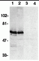 SODD Peptide