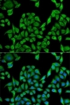 UGT1A1 Antibody