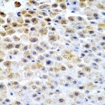 TFPI2 Antibody