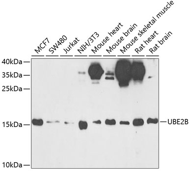 UBE2B Antibody