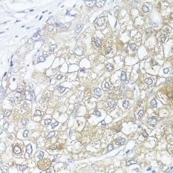 ASL Antibody