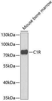 C1R Antibody