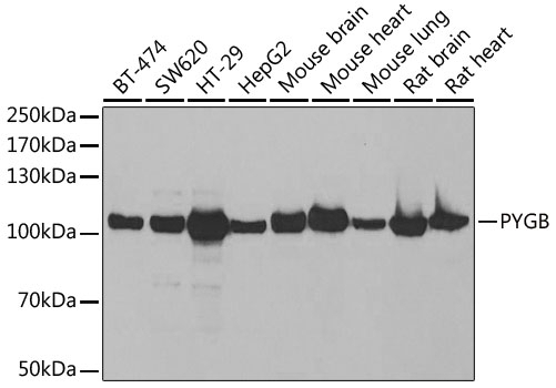 PYGB Antibody