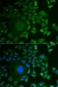 C1D Antibody