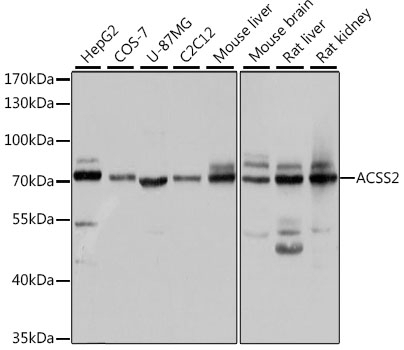 ACSS2 Antibody
