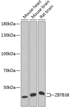 ZBTB38 Antibody