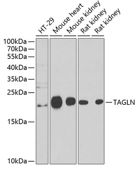 TAGLN Antibody