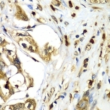 TMOD4 Antibody