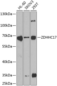ZDHHC17 Antibody
