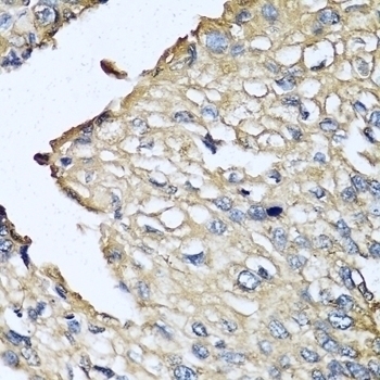 ASIP Antibody