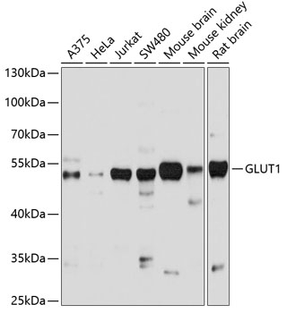 GLUT1 Antibody