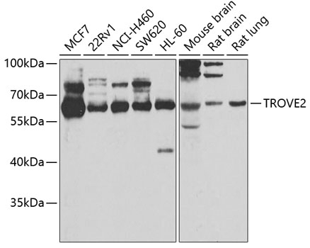 TROVE2 Antibody