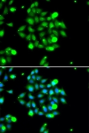 UBE2G1 Antibody
