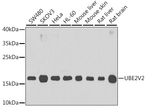 UBE2V2 Antibody