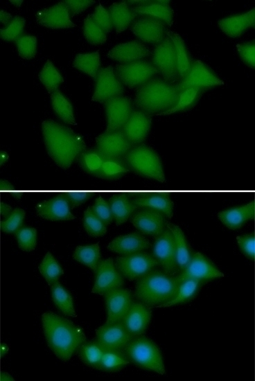 CAMK1 Antibody