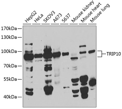 TRIP10 Antibody