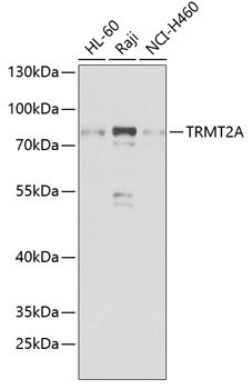 TRMT2A Antibody