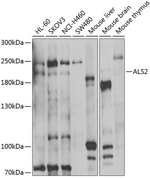 ALS2 Antibody