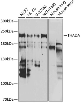 THADA Antibody