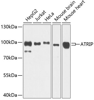 ATRIP Antibody
